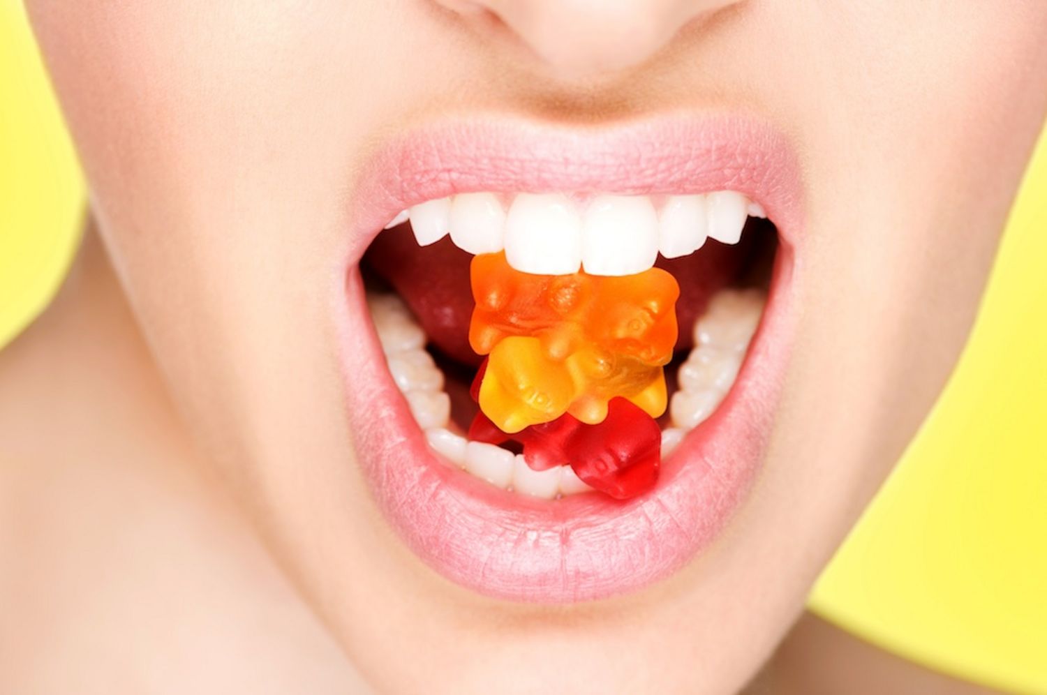 La clínica dental Dentalarroque indica que una pobre dieta puede producir caries en boadilla. Cuida de tu salud bucal.