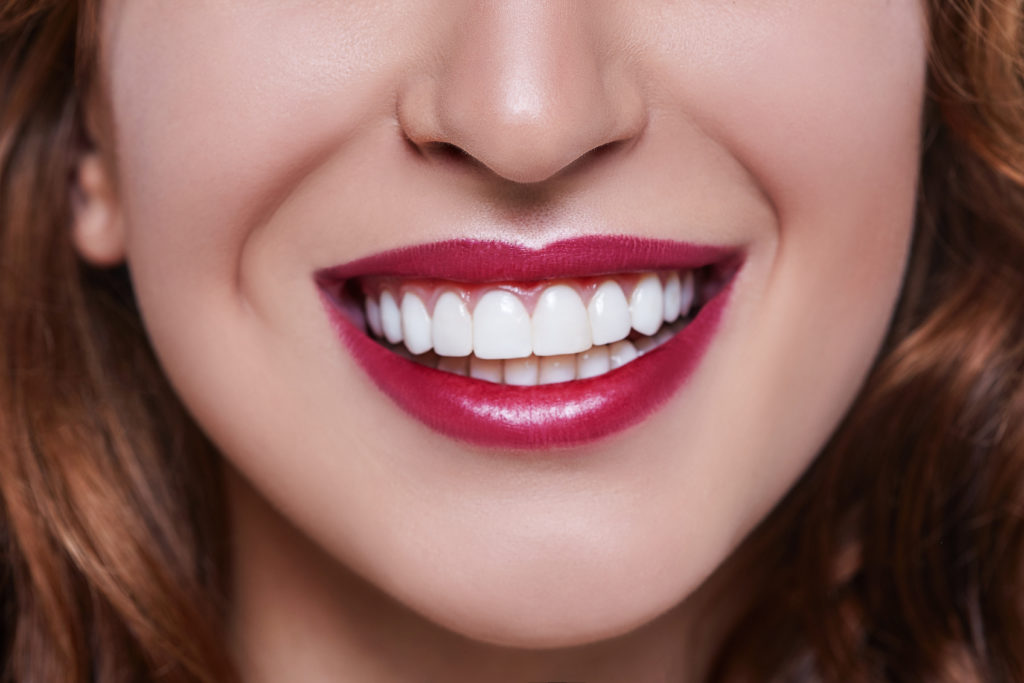 El dentista en Dentalarroque indica que las carillas dentales en majadahonda sirven para tratar problemas de estética en los dientes. Consigue la sonrisa de tus sueños.