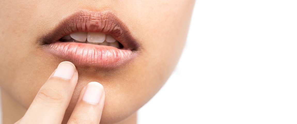 Las clínicas dentales Dentalarroque indican que la sequedad bucal ocurre por culpa de ciertas enfermedades. Es importante mantener la boca húmeda.