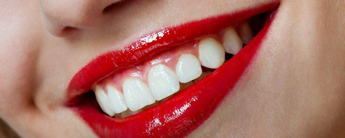 La clínica dental Dentalarroque indica algunas de las 5 razones para poner carillas dentales: se ven como los dientes permanentes, es un tratamiento cómodo y rápido y es perfecto para tratar imperfecciones dentales. Consigue la sonrisa de tus sueños.