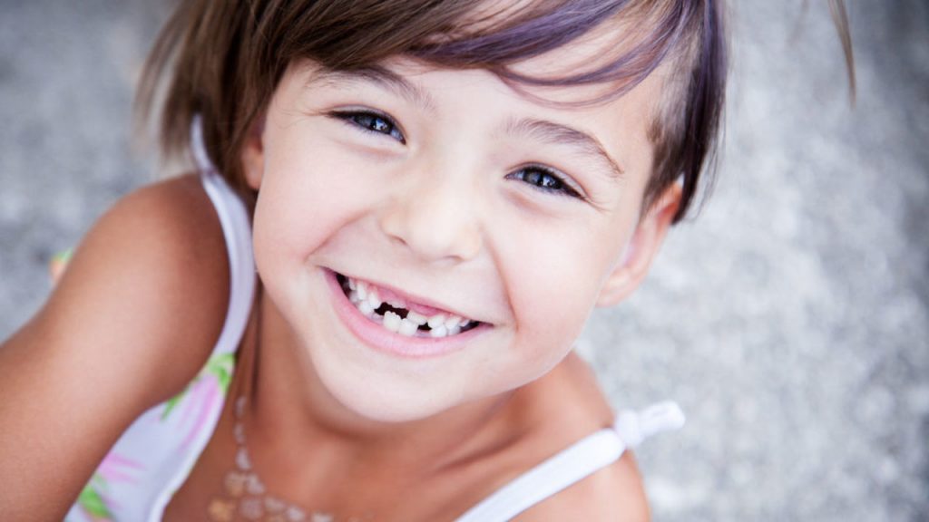 La caída prematura de los dientes de leche es uno de los 10 problemas dentales comunes en niños.