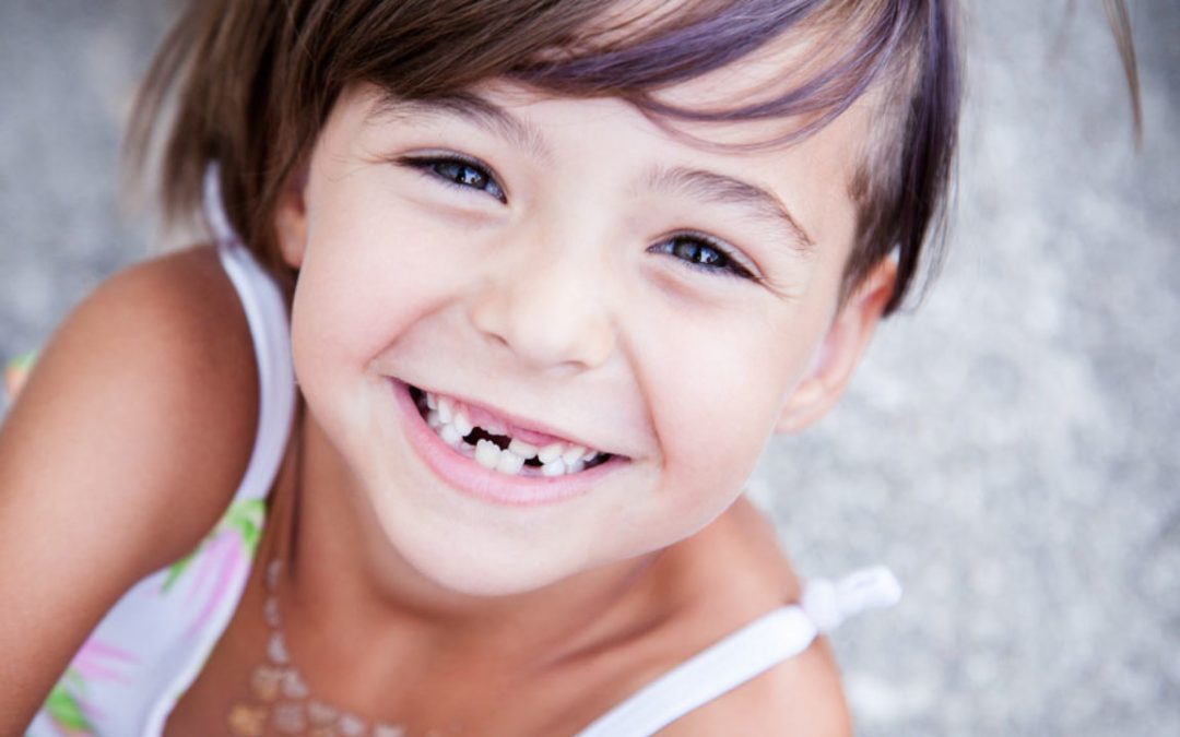 La caída prematura de los dientes de leche es uno de los 10 problemas dentales comunes en niños.